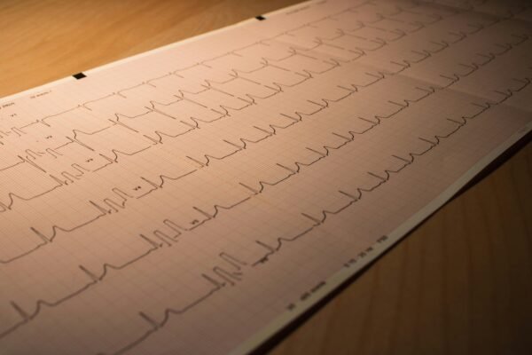 Heart Attack Damage Could Be Reversed by Reactivating a Dormant Gene Close-up of an ECG printout depicting heart activity, placed on a wooden surface.