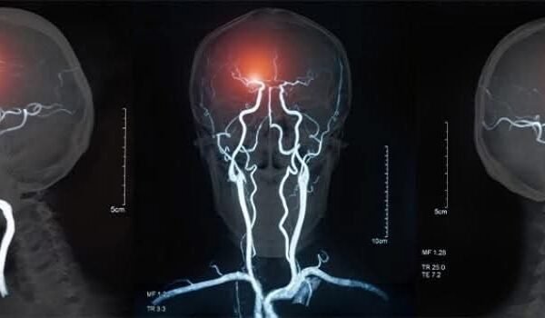 Anthropic’s ‘Brain Scanner’ Reveals Surprising Reasons Behind AI Math Errors and Hallucinations